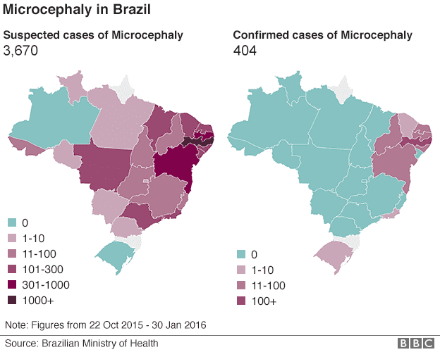 number of microcephaly cases brazil